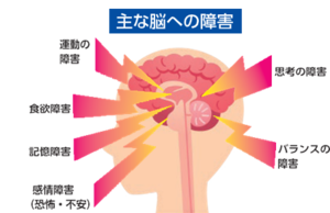 主な脳への障害