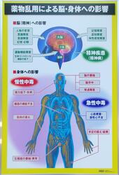 薬物乱用による脳・身体への影響