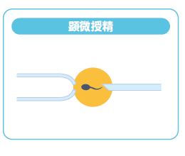 顕微授精の図