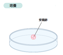 培養の図