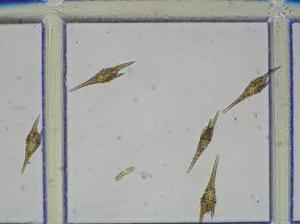 Ceratium sp.の写真
